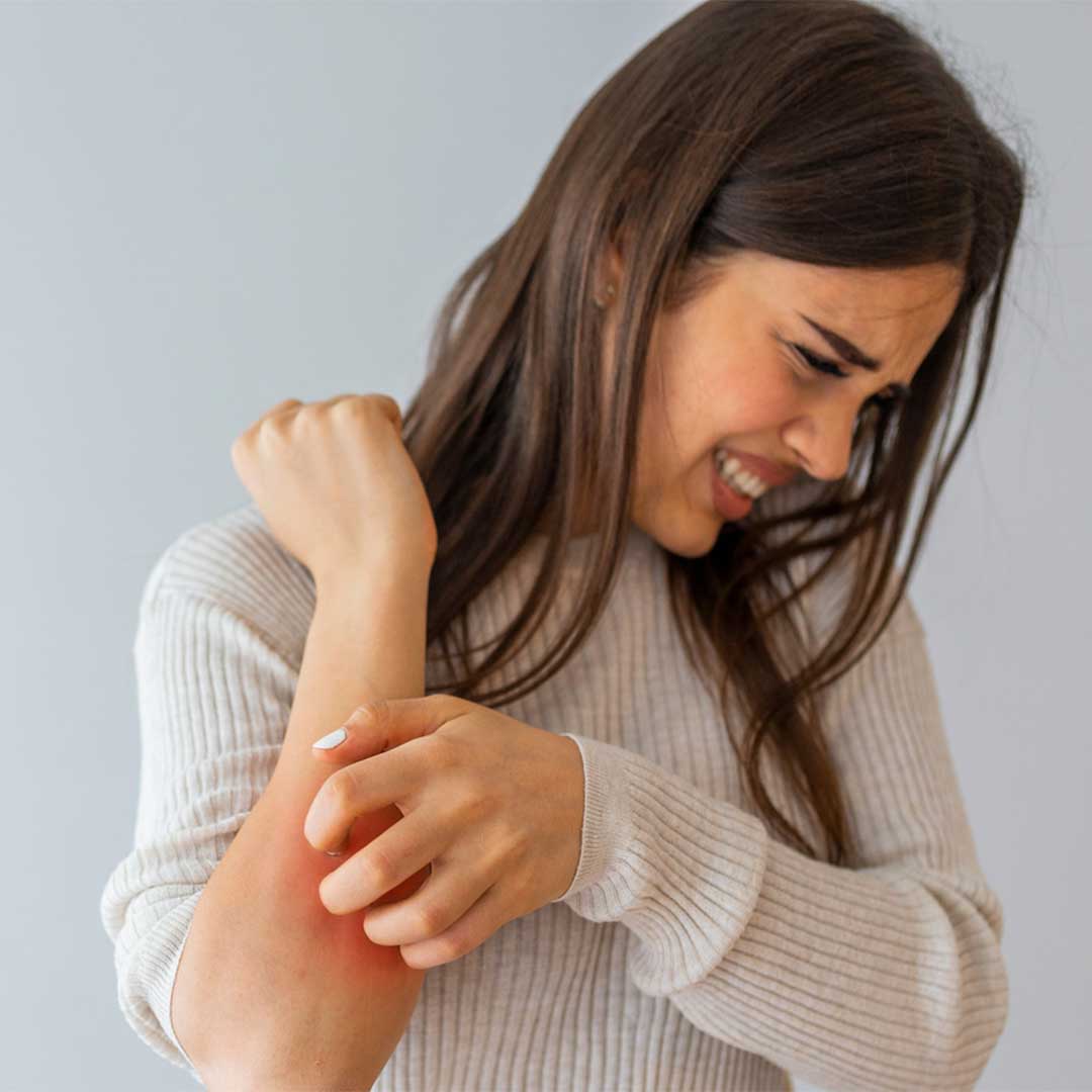 Itchy Skin in Rainy Season